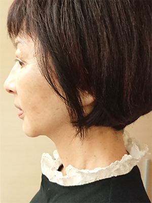 shirashira愛用者分享圖片